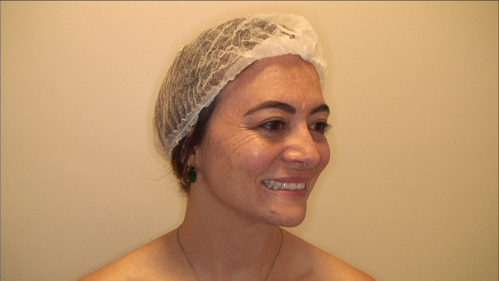Por que aplicar Botox antes dos 30 anos?
