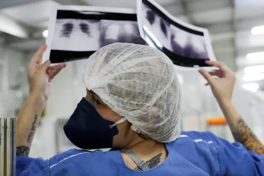 _radiografia_de_torax_coronaviruscovid-19_hospital_sao_paulo1205200325